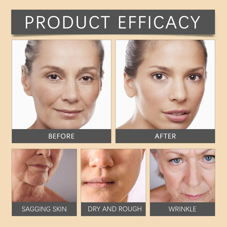 OUHOE Botox Bee Venom Wrinkle Cream – Natural Botox Effect, Anti-Aging & Firming Face Cream (20g)